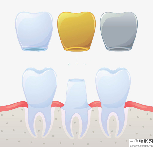 關于牙齒缺損，磨損怎么辦以及補牙速度快嗎