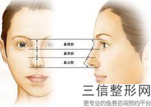 3D隆鼻整形的價格、效果、副作用等詳細介紹