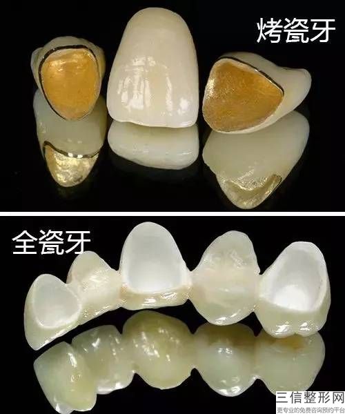 大連洗牙一次多少錢？大連齒醫生醫院的專家們告訴大家