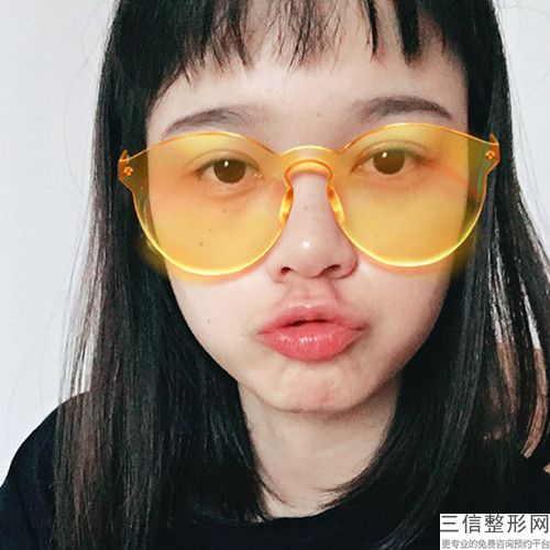 女性月經(jīng)期間可以割雙眼皮嗎？專家：良好不要有