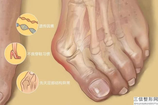 無(wú)錫哪里大腿抽脂好，價(jià)格多少？大腿吸脂有什么好處