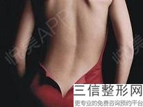 青島大腿吸脂平修多少錢？青島美容整形中心告訴你