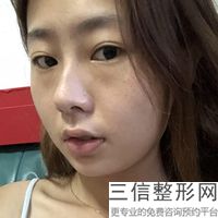 深圳的陰唇之美在哪里？價格是多少？？