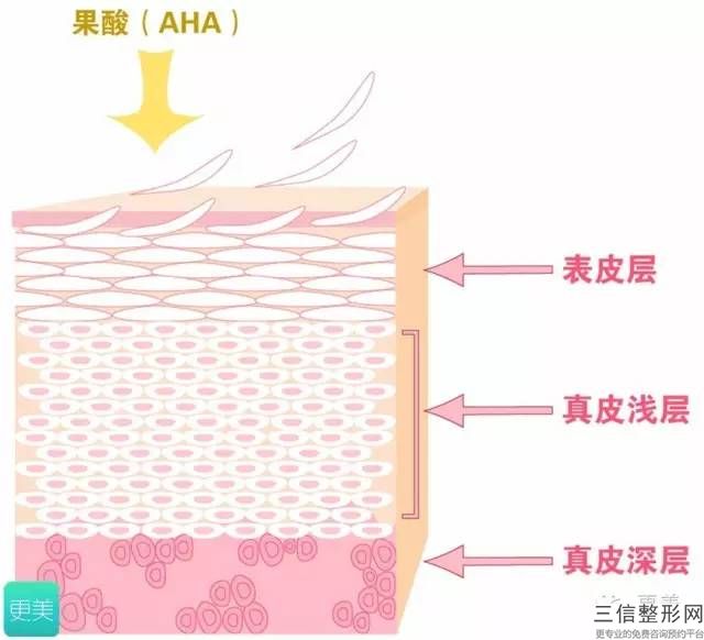 激光治療疤痕危險嗎？激光疤痕治療的注意事項！