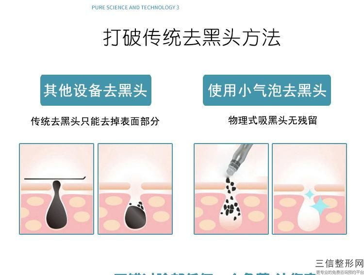 生物除皺針手術(shù)價格和什么因素有關(guān)？別再讓它遮擋肌膚的美麗！