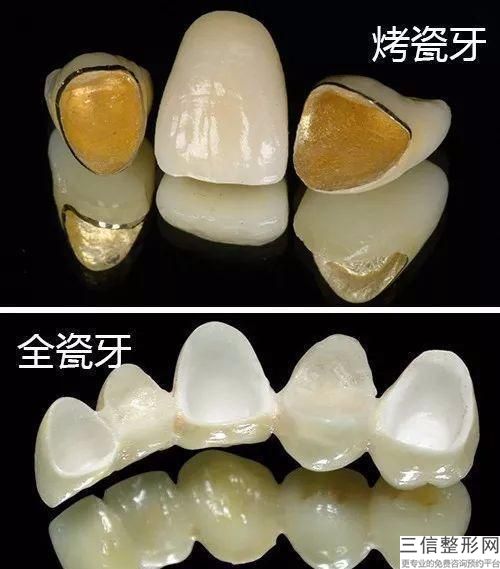 種植牙齒高不高？有啥功效