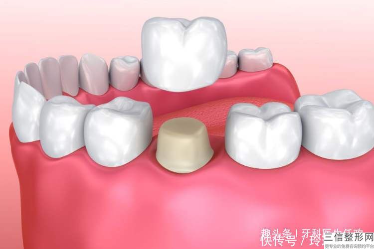 大連兒童矯正牙齒價格是多少（大連牙齒矯正價格多少錢）