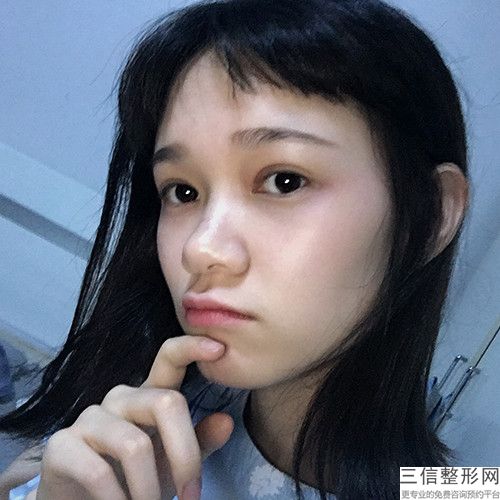 長沙雙眼皮整形醫院排名！長沙雅美醫療美容醫院不容錯過