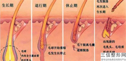 淮北市中年人植發價格表(收費標準)(2023年01月31日中年人植發均價為：30814元)