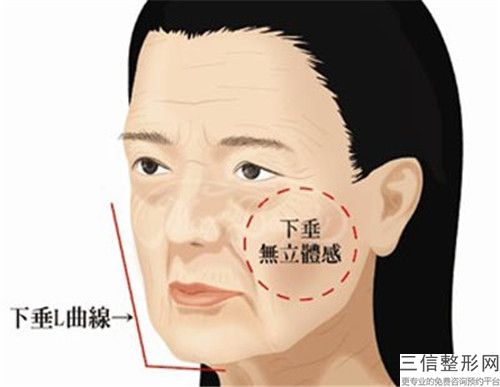 北京市保妥適瘦臉口碑榜前五-前八今日亮相（北京市保妥適瘦臉整形醫(yī)院）