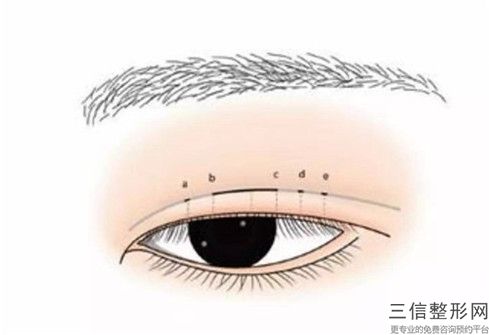 江西省眼部除皺修復醫生口碑榜前十佳專業敲定-江西省眼部除皺修復整形醫生