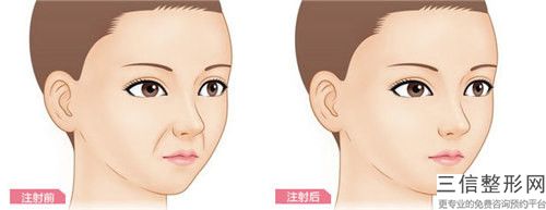 包頭市小切口顳部除皺術全新價格表【價目表】一覽(10月-4月均價為：3226元)