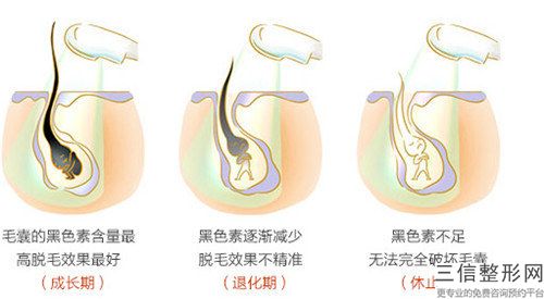 聊城fut陰毛種植手術費用花費要多少