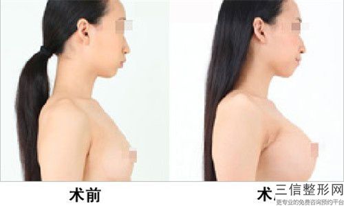 遼寧省淡化乳暈醫院排行前十強口碑甄選（遼寧省淡化乳暈整形醫院）