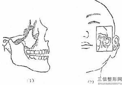 貴州省自體骨墊下巴醫(yī)生排名榜十強正規(guī)人氣醫(yī)生-王自謙醫(yī)生誰技術(shù)更厲害