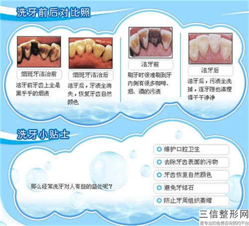 寧波市可麗爾博士牙套矯正醫生名單匯總-寧波市可麗爾博士牙套矯正口腔醫生