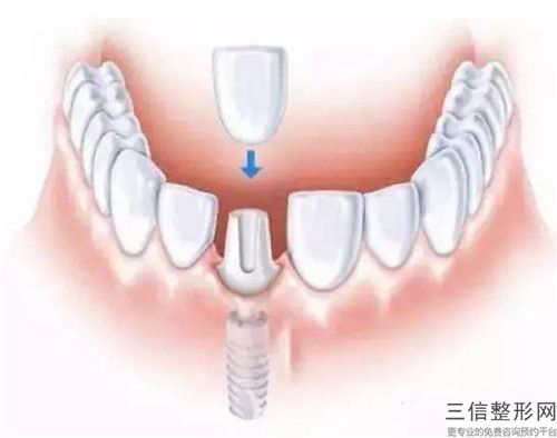 2023年黑龍江省治療黃牙醫院排名前十位大綜合匯總-黑龍江省治療黃牙口腔醫院