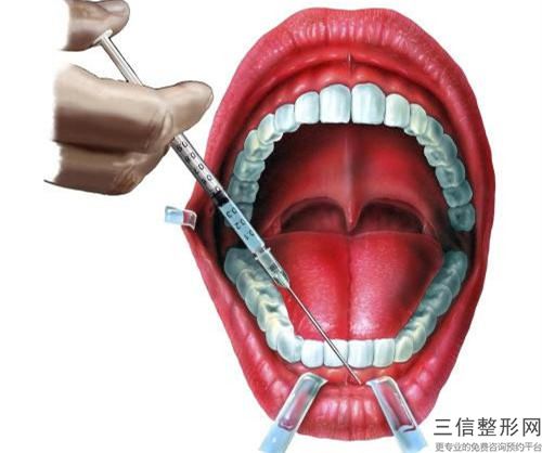 2023年成都市牙齒檢查醫院排名榜前十強匯總-成都市牙齒檢查口腔醫院