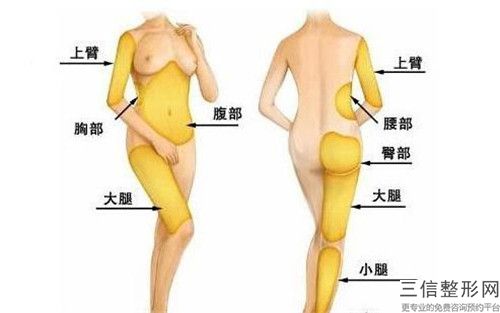 中國抽脂減肥瘦大腿醫院推薦：抽脂減肥瘦大腿醫院前50佳全新陣容發布