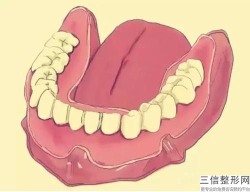 眉山非埋入式種植牙術后需要怎么護理才能恢復好