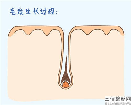 國內哪個整形醫院植發補發做的好：植發補發醫院前50佳盤點