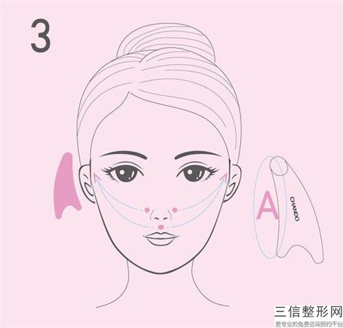 射頻除皺激光除皺后影響懷孕嗎、有壞處嗎