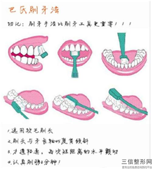 連橋修復(fù)牙齒都有哪些后遺癥呢