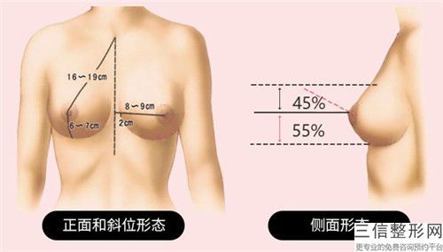 南京市整形醫(yī)院胸部整形整形手術(shù)-江蘇施爾美整形更有優(yōu)勢(shì)