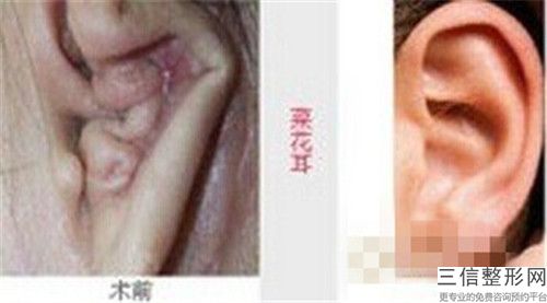 中國治療先天耳畸形醫院推薦：治療先天耳畸形醫院前50免費了解