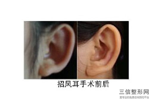 全國外耳再造注水醫院推薦：外耳再造注水醫院前50位網友力挺