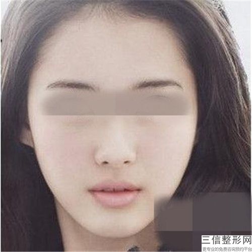 天津伊顏美整形美容醫院醫生簡介附雙下巴女人案例