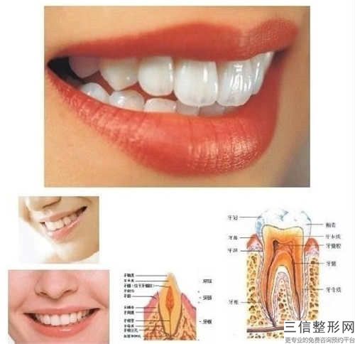 邢臺美容冠矯正兔牙會有害處嗎