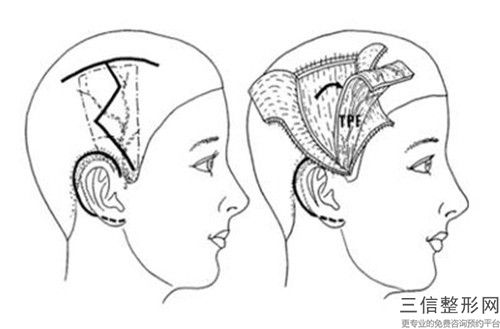 整容醫院耳畸形治療推薦：耳畸形治療醫院top30公認推薦