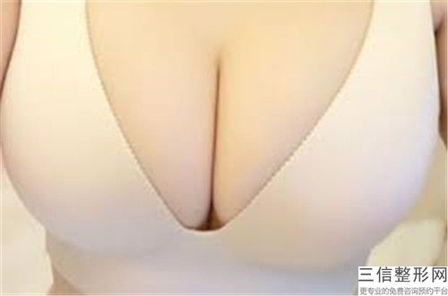 舟山艾美醫(yī)療美容醫(yī)院縮小乳暈手術需要價格多少呢