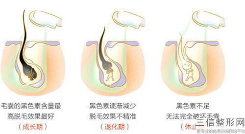 植發(fā)術(shù)整形效果與植發(fā)攻略_毛發(fā)移植要怎么顯現(xiàn)更大生發(fā)效果