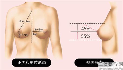 隆胸整形術(shù)效果不佳改如何復(fù)原