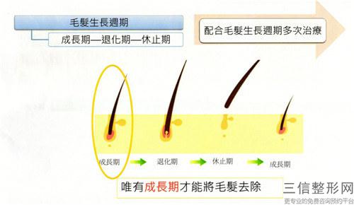 激光脫毛整形美容法會不會長久有效呢