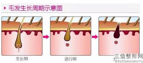 彩光長久脫毛與冰點脫毛有些什么不同點