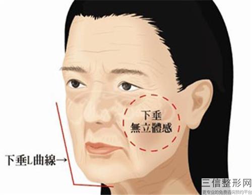 琴面假體隆胸危害喂奶嗎？術后有些什么常見問題？