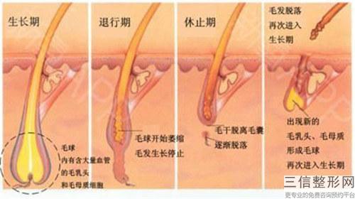 激光美容脫毛多少元可實行一次？能夠保持多長時間？